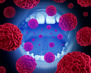 'cancer cells in mouth'
