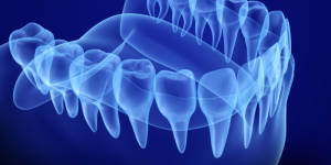 Jaw X-Ray 
